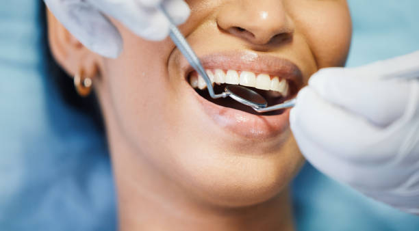 Best Walk-In Emergency Dentist in Perrysburg, OH