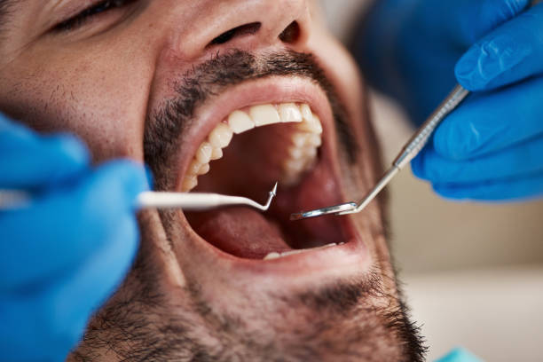 Best Emergency Tooth Extraction in Perrysburg, OH